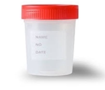 URINE CULTURE BOTTLE